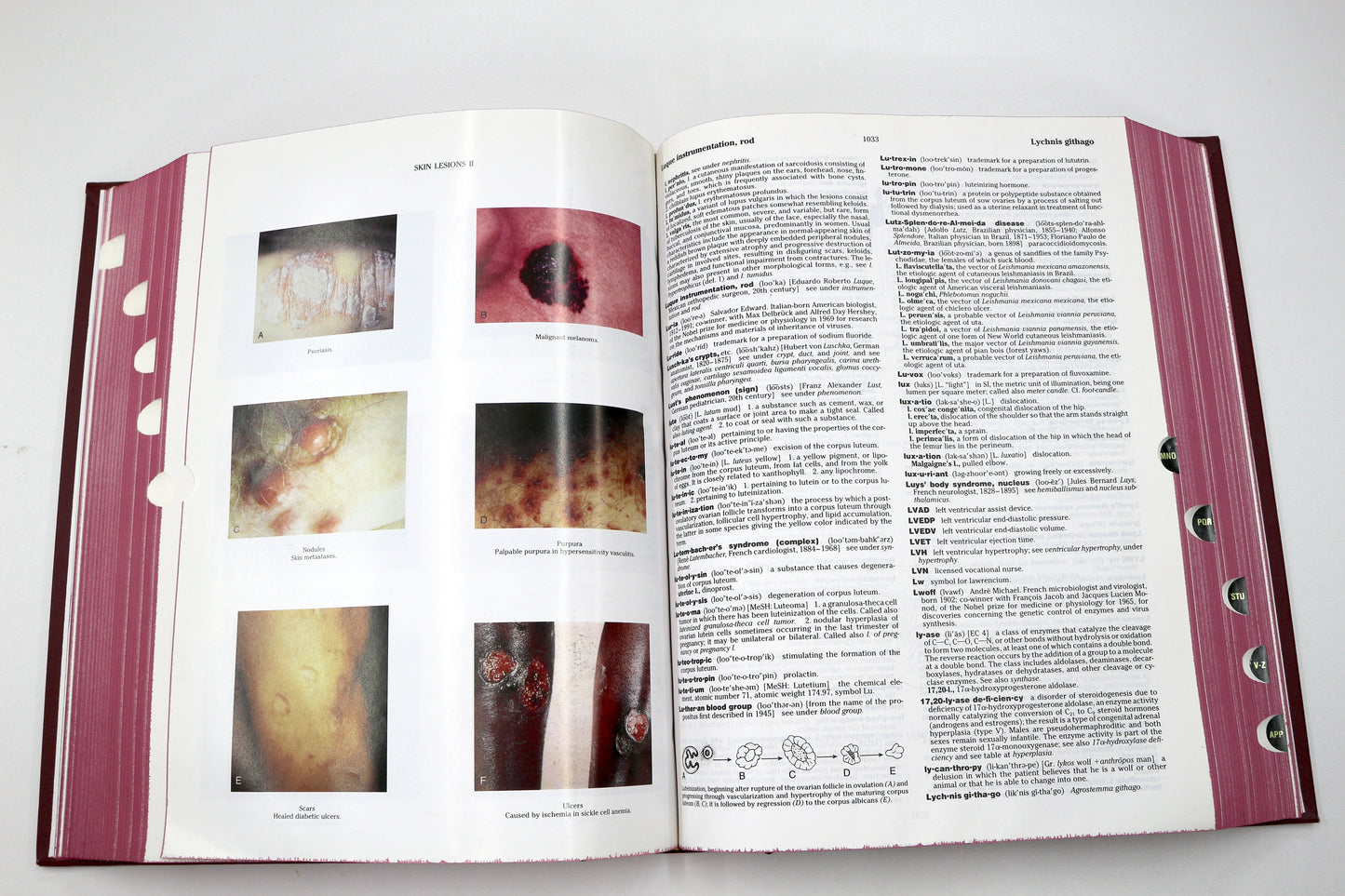 Dorland’s Illustrated Medical Dictionary – 29th Edition (Hardcover)