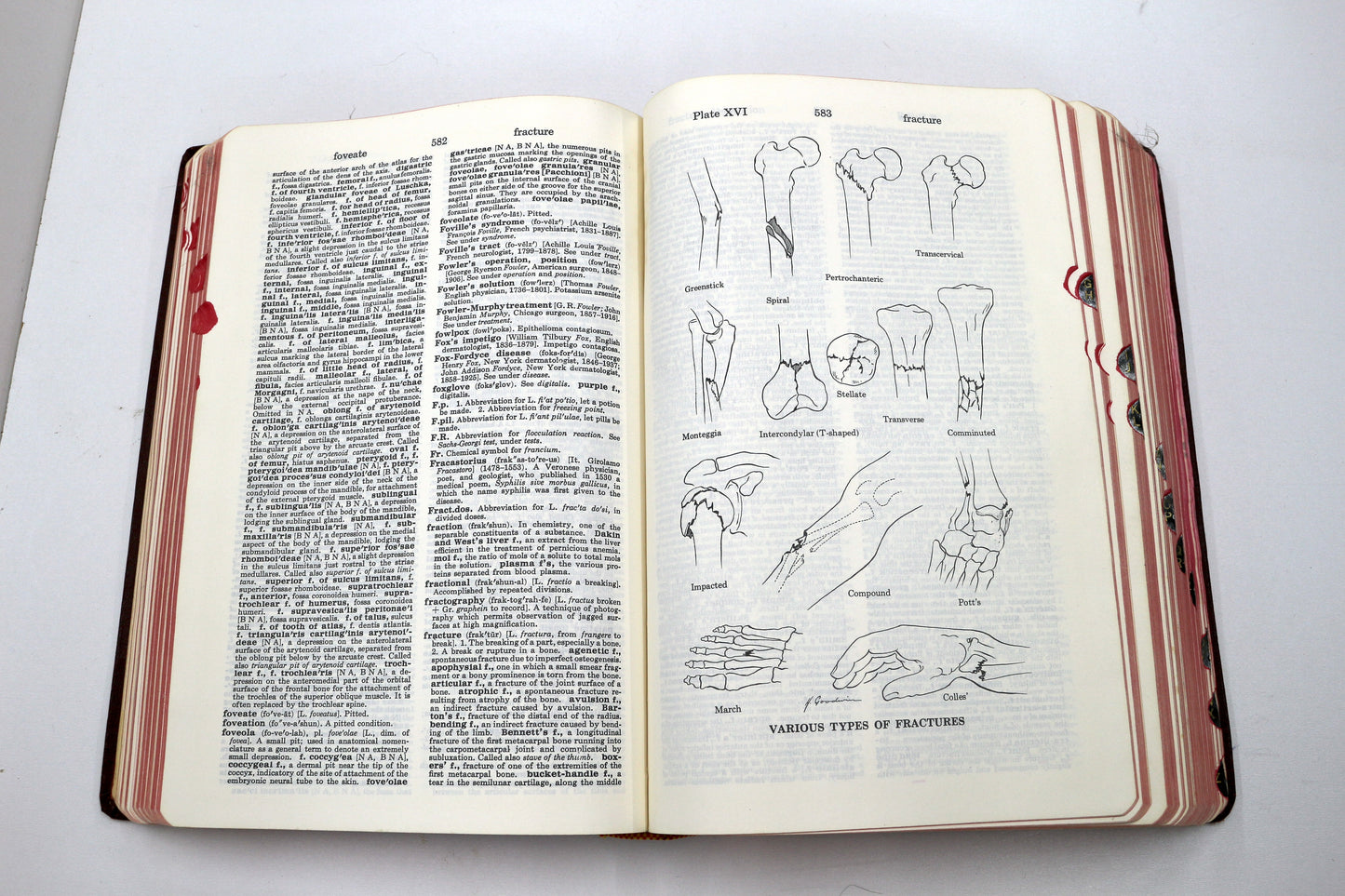 Dorland’s Illustrated Medical Dictionary – 24th Edition (Hardcover)